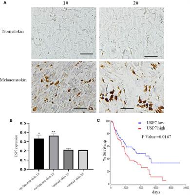 Proteome Analysis of USP7 Substrates Revealed Its Role in Melanoma Through PI3K/Akt/FOXO and AMPK Pathways